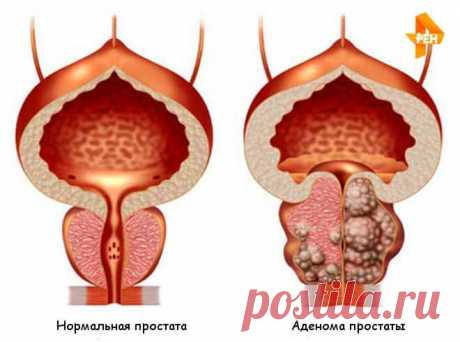 Получить PROSTERO ЗА 99 ГРН.! Реальные отзывы. Закажите PROSTERO сейчас!