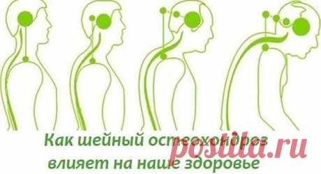 1.      Я — онколог. И вот 5 вещей, которые я бы сделал НЕМЕДЛЕННО, будь у меня рак!
2.      ЗАМОРОЖЕННЫЕ ЛИМОНЫ — ПРОФИЛАКТИКА РАКА
3.     Даже самые глубокие морщины разгладятся всего за неделю! Уникальный рецепт омоложения!
4.      НЕВЕРОЯТНО - НО - ФАКТ !, Свекла лечит не хуже лекарств !
5.     Кушала эту смесь, и забыла о свисающем животе!
6.      НАРОСТЫ НА КОСТЯХ .
7.      Ягода пяти вкусов.
8.      Дамам в возрасте - вместо ботокса.
9.      БОЛИТ ШЕЯ? КАК ШЕЙНЫЙ ОС...