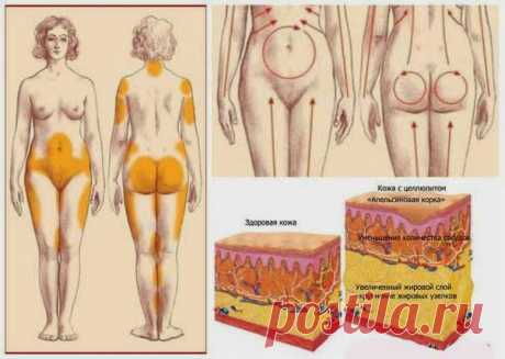 Всё самое интересное!: СРЕДСТВА ПРОТИВ ЦЕЛЛЮЛИТА