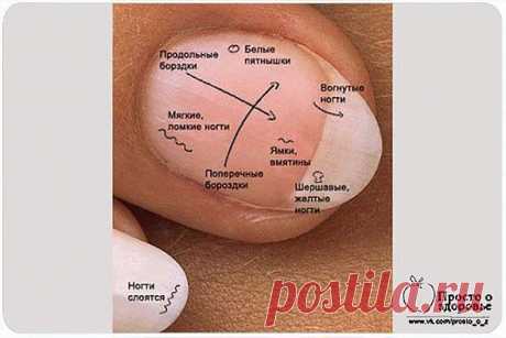 Ногти на пальцах рук могут многое рассказать о здоровье..