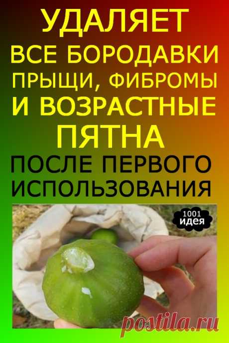 как вывести бородавки на руках мясом	Лечение и удаление бородавок народными средствами? Узнаем, чем и как вывести кожныеБородавки — это доброкачественное контагиозное (заразное) поражение кожи, имеющее видБородавки могут появляться на руках, на ногах, практически на любой части тела человека, и...