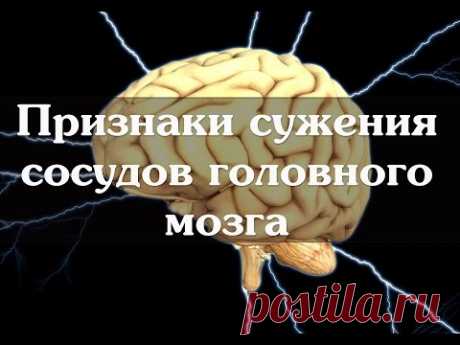 Признаки сужения сосудов головного мозга