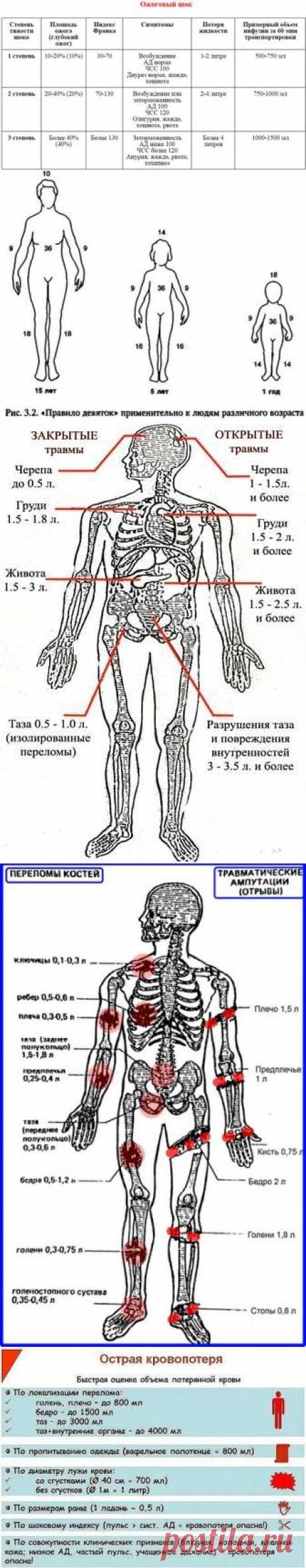 Ожоговый шок. Кровопотеря при травмах.