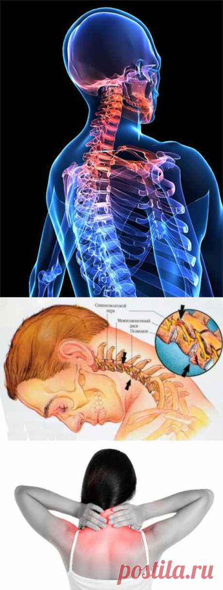 Боль в шее сзади слева или справа: причины и лечение
