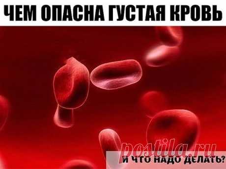 ЕСЛИ ГУСТАЯ КРОВЬ, ЧТО ДЕЛАТЬ?

Ни для кого не секрет, что густую кровь нужно разжижать, чтобы предотвратить тромбоз.

Профилактика образования тромбов

1. Пейте больше воды! 90% людей пьют очень мало воды. Речь именно о кипяченой природной воде, а не о жидкостях. Взрослый человек должен выпивать ежедневно 2-2,5 литра воды. В жaру еще больше. Приучайте своих детей пить воду. Натуральная вода — первое и очень мощное средство против образования тромбов.

2. Продукты для разж...