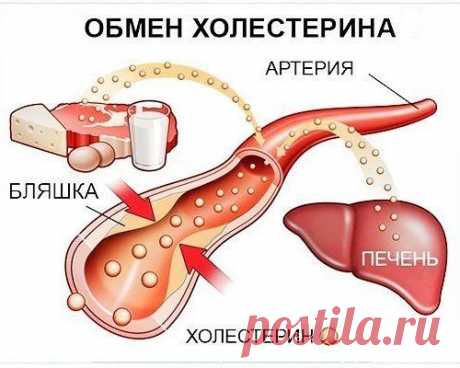 Уровень холестерина можно снизить без проблем!