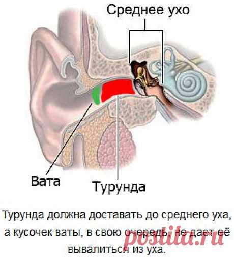 Лечение отита в домашних условиях. И ЗДЕСЬ --- https://www.hw-lecar.ru/trawnic/psich/3otit.shtml