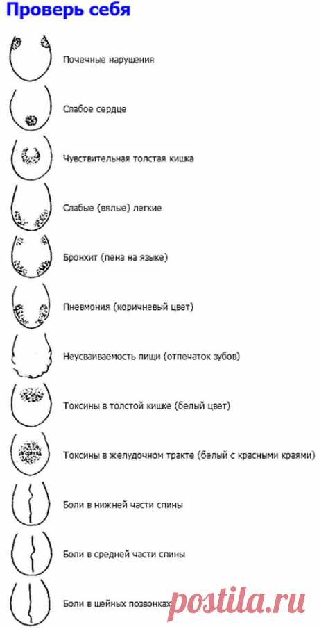 Проверьте себя! Язык расскажет о проблемах в организме