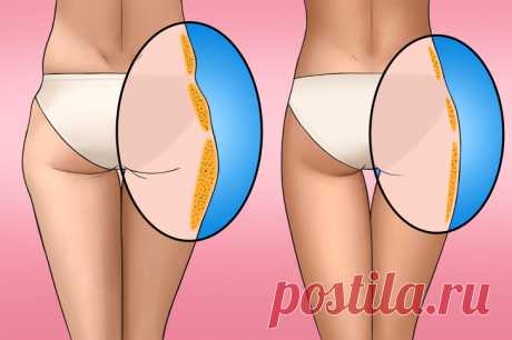 Как убрать «ушки» на бедрах, которые портят фигуру Жировые отложения на внешней стороне бедер называются «ушками» или «галифе» из-за треугольной формы.