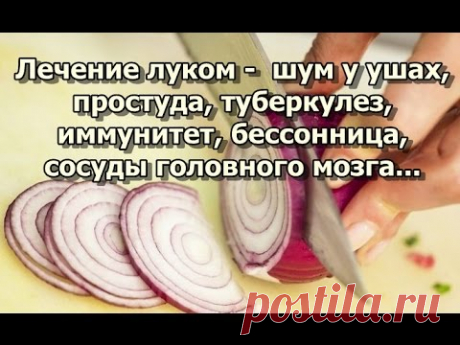 Лечение луком - шум у ушах, простуда, туберкулез, иммунитет, бессонница, сосуды головного мозга...