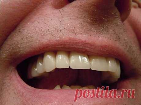 Неочевидные правила чистки зубов | Bixol.Ru