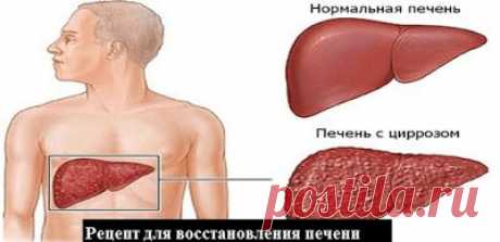 ♥Папа, мама, я - здоровая семья♥: Очень простой и дешёвый способ восстановить печень. Рецепт проверен на больных циррозом печени, даже осложнённым водянкой.