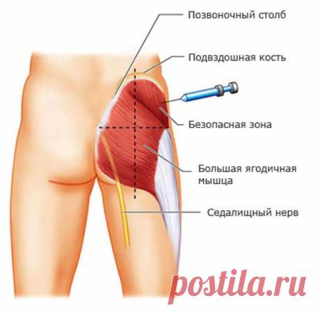 Под каким углом делать инъекции?