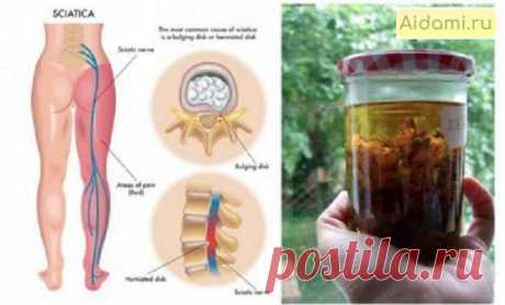 Лечите боль седалищного нерва без лекарств: 4 мощные травы | АйДаМы | У нас Всегда лучшее