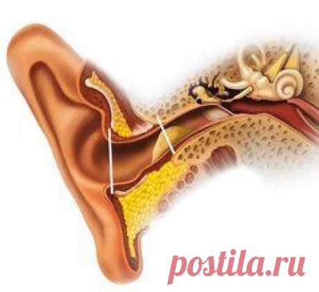 Серная пробка в ушах в ушах: удаление в домашних условиях / Будьте здоровы