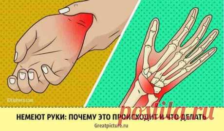 Немеют руки: почему это происходит и что делать