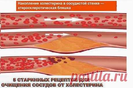 Всё самое интересное!: Хвойный настой с шиповником для очищения сосудов!