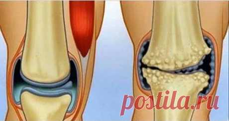 Природные противовоспалительные средства, которые творят чудеса для суставов и боли в коленях! | Naget.Ru
