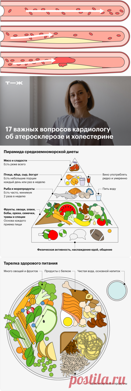 17 важных вопросов кардиологу об атеросклерозе и рисках заболеваний сердца