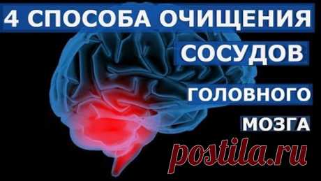 4 способа очистки сосудов головного мозга народными средствами.