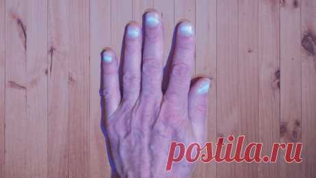 «Светятся ногти»: переболевшие COVID-19 столкнулись с необычным явлением