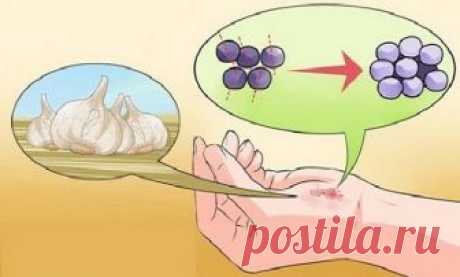 Чеснок убивает 14 видов рака и 13 типов инфекции. Почему врачи его не прописывают? - CELEBNIK. RU Самым мощным природным средством против многих заболеваний является чеснок, поэтому список болезней,...