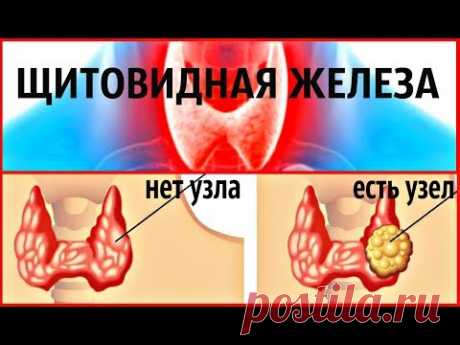 МОЙ ОПЫТ ИЗЛЕЧЕНИЯ УЗЛОВ ЩИТОВИДНОЙ ЖЕЛЕЗЫ, НЕ ДЛЯ ЭСТЕТОВ