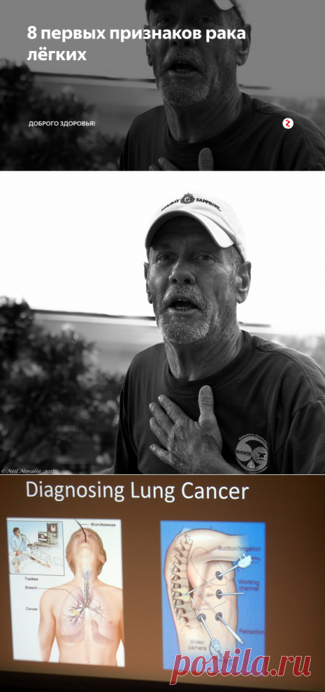 8 первых признаков рака лёгких | Доброго здоровья! | Яндекс Дзен