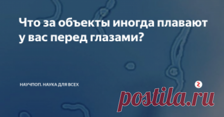 Что за объекты иногда плавают у вас перед глазами? Обращали ли вы внимание на то, что иногда вы видите, как какие-то невесомые объекты парят в воздухе перед вашими глазами? Они могут походить на маленькие шерстинки, напоминать по форме крошечных червячков, паутинки или прозрачные сгустки.
Muscae valitantes или "мушки". Источник изображения: fanpage.gr
Если вы пробуете приглядеться к этим объектам, то они внезапно пропадают, но опять возникают, пос