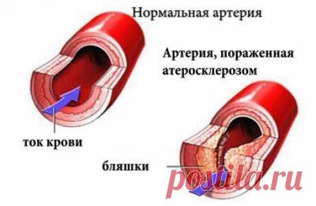 (+1) тема - Как укрепить сосуды? | ЗДОРОВЫЙ ОБРАЗ