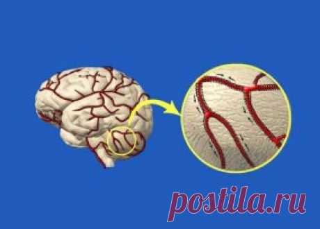 Как очистить сосуды головного мозга. Мощные рецепты народной медицины!