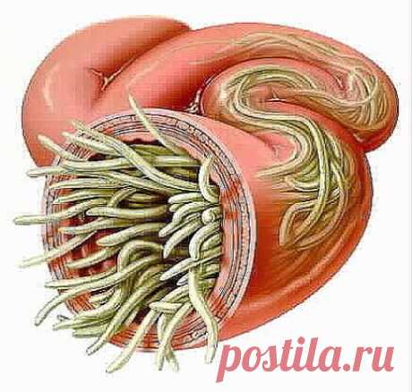 МЕДОВАЯ ВОДА ИЗГОНИТ ПАРАЗИТОВ , ПОМОЖЕТ ПОХУДЕТЬ И МНОГО ДРУГОЕ!