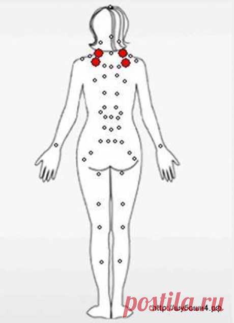 Точки китайской медицины при лечении опорно-двигательного аппарата приборами Шубоши - Комфорт