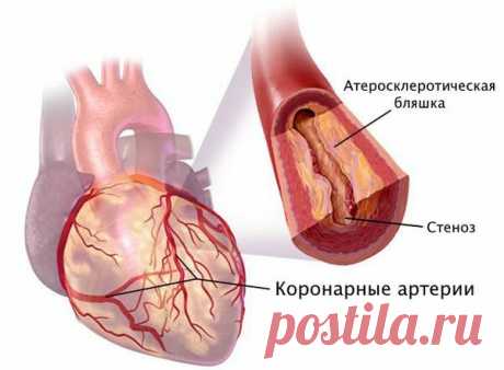 Как понять, что болит именно сердце. Симптомы. | Кардиолог Константин Крулёв | Дзен