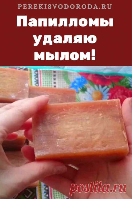 Папилломы удаляю мылом: вот как я это делаю