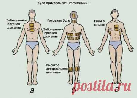 Как правильно ставить горчичники