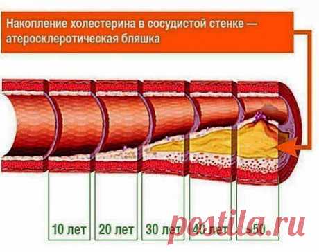 Проверенные поколениями народные средства для сосудов..