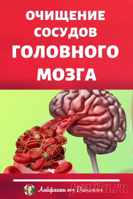 Очищение сосудов головного мозга – улучшение памяти и профилактика инсульта. Здоровье в домашних условиях