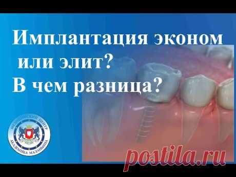 Имплантация эконом или элит? В чем разница?