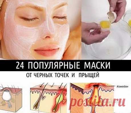 24 ПОПУЛЯРНЫЕ МАСКИ ОТ ЧЕРНЫХ ТОЧЕК И ПРЫЩЕЙ!