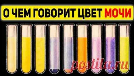 ВСЕ БОЛЕЗНИ ПО ЦВЕТУ МОЧИ: 2 тыс изображений найдено в Яндекс Картинках