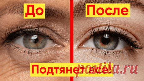 Мощный лифтинг комплекс для кожи вокруг глаз – подтянет нависшие веки | YKrasotka | Дзен