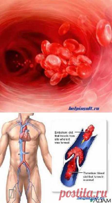 Средства для разжижения крови |