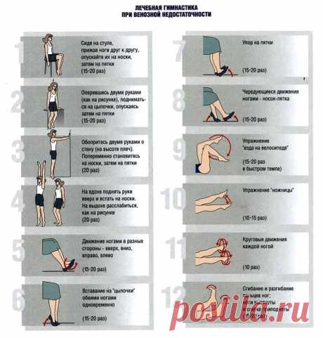 Лечебная гимнастика при венозной недостаточности
