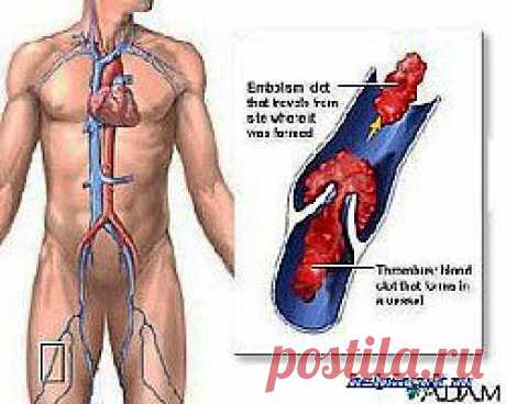 Средства для разжижения крови |