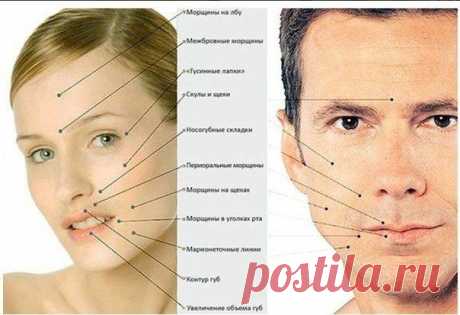 О чем говорят морщины на лице