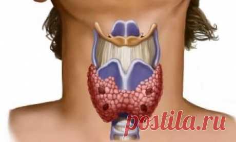 Признаки болезни щитовидной железы