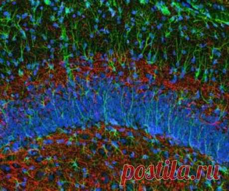 Мозг чистит память с помощью новых нервных клеток