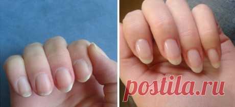 Как быстро отрастить ногти, которые никогда не сломаются: поможет простое средство из 4 компонентов! - Живой Журнал Леди