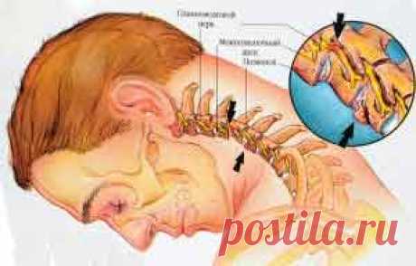 7 ПРОСТЫХ УПРАЖНЕНИЙ ДЛЯ ЛЕЧЕНИЯ ОСТЕОХОНДРОЗА И ШЕЙНОГО ОТДЕЛА ПОЗВОНОЧНИКА | Domosedkam.ru